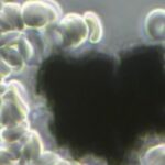 La microscopia elettronica a scansione e trasmissione rivela l'ossido di grafene nei vaccini CoV-19