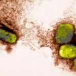 Usa, trovate fiale etichettate "vaiolo" in un laboratorio per vaccini della Merck 