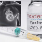Revisione studi sulle miocarditi dopo il vaccino, rivela un importante dato per la salute pubblica