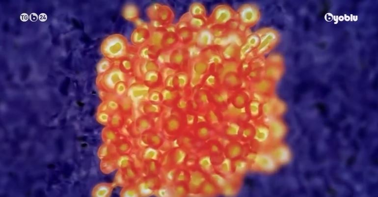 Vaccino Covid: troppe dosi possono paralizzare il sistema immunitario e aumentare il rischio di contrarre l’HIV (immunodeficienza)