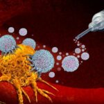 Rapida progressione del linfoma angioimmunoblastico a cellule T dopo l'iniezione di richiamo del vaccino Pfizer: un caso clinico