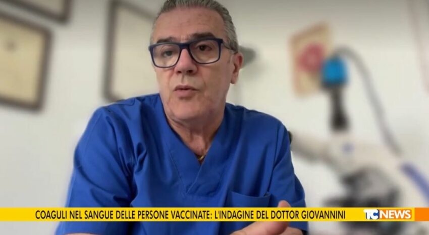 Indagine del Dott. Giovannini scopre coaguli di globuli rossi in persone sottoposte a vaccinazione anticovid anche dopo la prima dose