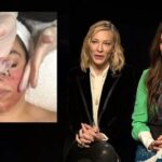 Sandra Bullock e Cate Blanchett: il prepuzio dei neonati come rimedio anti-età